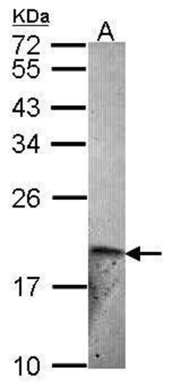 Invitrogen Endothelin 2 Polyclonal Antibody 100 &mu;L | Buy Online | Invitrogen&trade; | Fisher Scientific