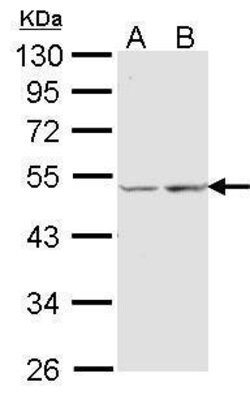 COX15 Polyclonal Antibody:Antibodies, Polyclonal