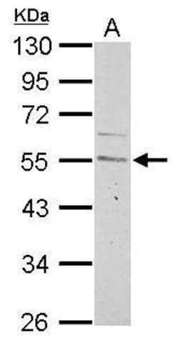 Invitrogen Cyclin A2 Polyclonal Antibody 100 &mu;L; Unconjugated:Antibodies,