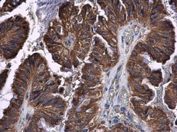 Invitrogen STAT2 Polyclonal Antibody 100 &mu;L; Unconjugated:Antibodies,