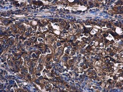 Invitrogen STAT2 Polyclonal Antibody 100 &mu;L; Unconjugated:Antibodies,