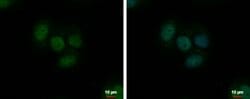 Invitrogen TrxR1 Polyclonal Antibody 100 &mu;L; Unconjugated:Antibodies,