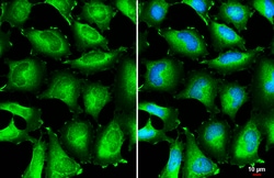 Invitrogen&trade;&nbsp;BIN1 Polyclonal Antibody