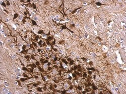 Invitrogen Calretinin Polyclonal Antibody 100 &mu;L; Unconjugated:Antibodies,