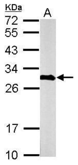 Invitrogen Calretinin Polyclonal Antibody 100 &mu;L; Unconjugated:Antibodies,