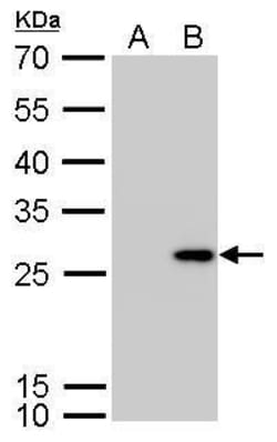 Invitrogen Calretinin Polyclonal Antibody 100 &mu;L; Unconjugated:Antibodies,