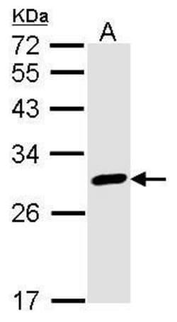 Invitrogen Calretinin Polyclonal Antibody 100 &mu;L; Unconjugated:Antibodies,