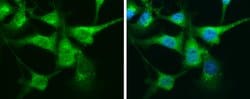 Invitrogen Calretinin Polyclonal Antibody 100 &mu;L; Unconjugated:Antibodies,