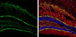 Invitrogen Calretinin Polyclonal Antibody 100 &mu;L; Unconjugated:Antibodies,