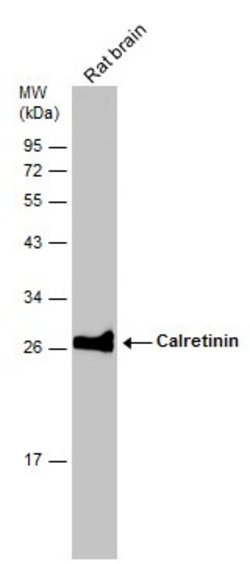 Invitrogen Calretinin Polyclonal Antibody 100 &mu;L; Unconjugated:Antibodies,