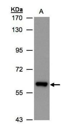 Invitrogen ALDH6A1 Polyclonal Antibody 100 &mu;L; Unconjugated:Antibodies,