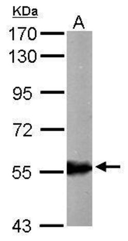 Invitrogen ALDH6A1 Polyclonal Antibody 100 &mu;L; Unconjugated:Antibodies,
