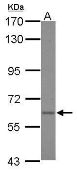 Invitrogen Asparagine Synthetase Polyclonal Antibody 100 &mu;L; Unconjugated:Antibodies,