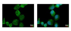 Invitrogen PAK1 Polyclonal Antibody 100 &mu;L; Unconjugated:Antibodies,