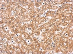 Invitrogen PAK1 Polyclonal Antibody 100 &mu;L; Unconjugated:Antibodies,