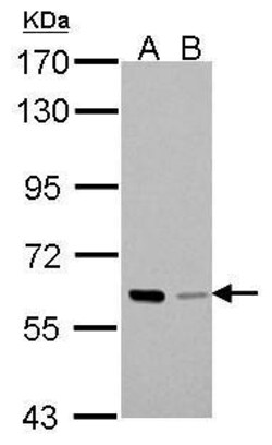 Invitrogen PAK1 Polyclonal Antibody 100 &mu;L; Unconjugated:Antibodies,