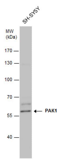 Invitrogen PAK1 Polyclonal Antibody 100 &mu;L; Unconjugated:Antibodies,