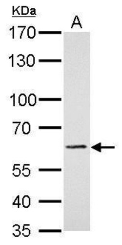 Invitrogen PAK1 Polyclonal Antibody 100 &mu;L; Unconjugated:Antibodies,