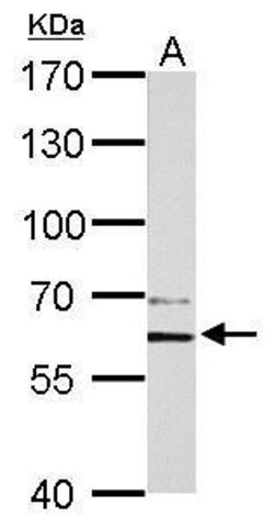 Invitrogen PAK1 Polyclonal Antibody 100 &mu;L; Unconjugated:Antibodies,
