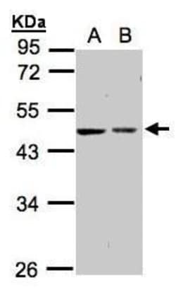 Invitrogen GALK2 Polyclonal Antibody 100 &mu;L; Unconjugated:Antibodies,