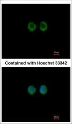 Invitrogen MOK Polyclonal Antibody 100 &mu;L | Buy Online | Invitrogen&trade; | Fisher Scientific