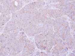 Invitrogen MOK Polyclonal Antibody 100 &mu;L | Buy Online | Invitrogen&trade; | Fisher Scientific