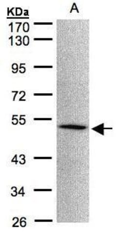 Invitrogen MOK Polyclonal Antibody 100 &mu;L | Buy Online | Invitrogen&trade; | Fisher Scientific