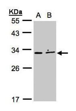 Invitrogen XRCC2 Polyclonal Antibody 100 &mu;L; Unconjugated:Antibodies,