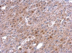 Invitrogen TNFAIP2 Polyclonal Antibody 100 &mu;L; Unconjugated:Antibodies,