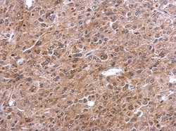 Invitrogen TNFAIP2 Polyclonal Antibody 100 &mu;L; Unconjugated:Antibodies,