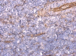 Invitrogen TNFAIP2 Polyclonal Antibody 100 &mu;L; Unconjugated:Antibodies,