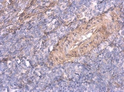 Invitrogen TNFAIP2 Polyclonal Antibody 100 &mu;L; Unconjugated:Antibodies,