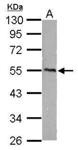 Invitrogen CaMKI gamma Polyclonal Antibody 100 &mu;L; Unconjugated:Antibodies,