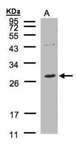 Invitrogen NTAL Polyclonal Antibody 100 &mu;L; Unconjugated:Antibodies,