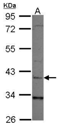 Invitrogen LRG1 Polyclonal Antibody 100 &mu;L; Unconjugated:Antibodies,