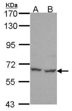 Invitrogen PNK Polyclonal Antibody 100 &mu;L; Unconjugated:Antibodies,