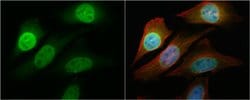 Invitrogen NFkB p65 Polyclonal Antibody 100 &mu;L; Unconjugated:Antibodies,