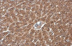 Invitrogen NFkB p65 Polyclonal Antibody 100 &mu;L; Unconjugated:Antibodies,
