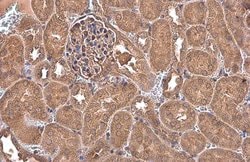 Invitrogen NFkB p65 Polyclonal Antibody 100 &mu;L; Unconjugated:Antibodies,