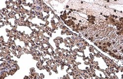 Invitrogen NFkB p65 Polyclonal Antibody 100 &mu;L; Unconjugated:Antibodies,