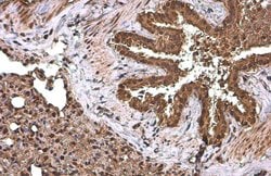 Invitrogen NFkB p65 Polyclonal Antibody 100 &mu;L; Unconjugated:Antibodies,