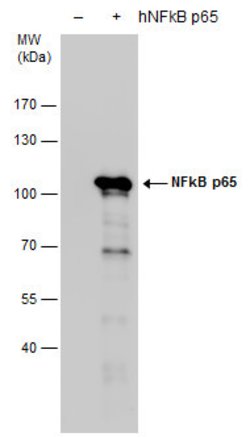 Invitrogen NFkB p65 Polyclonal Antibody 100 &mu;L; Unconjugated:Antibodies,