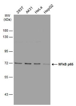 Invitrogen NFkB p65 Polyclonal Antibody 100 &mu;L; Unconjugated:Antibodies,