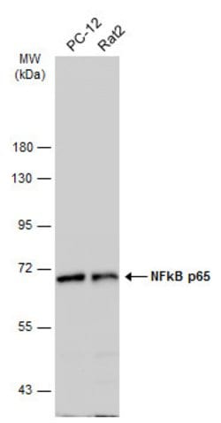 Invitrogen NFkB p65 Polyclonal Antibody 100 &mu;L; Unconjugated:Antibodies,