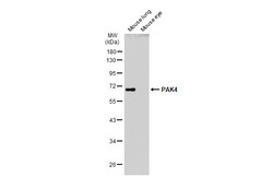 Invitrogen PAK4 Polyclonal Antibody 100 &mu;L; Unconjugated:Anticuerpos