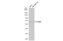 Invitrogen PAK4 Polyclonal Antibody 100 &mu;L; Unconjugated:Anticuerpos