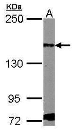 Invitrogen PDGFRA Polyclonal Antibody 100 &mu;L; Unconjugated:Antibodies,