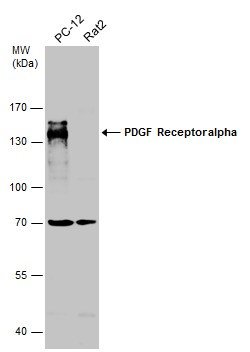 Invitrogen PDGFRA Polyclonal Antibody 100 &mu;L; Unconjugated:Antibodies,
