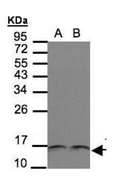 Invitrogen Thioredoxin 1 Polyclonal Antibody 100 &mu;L; Unconjugated:Antibodies,