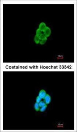 Invitrogen CMTM6 Polyclonal Antibody 100 &mu;L; Unconjugated:Antibodies,